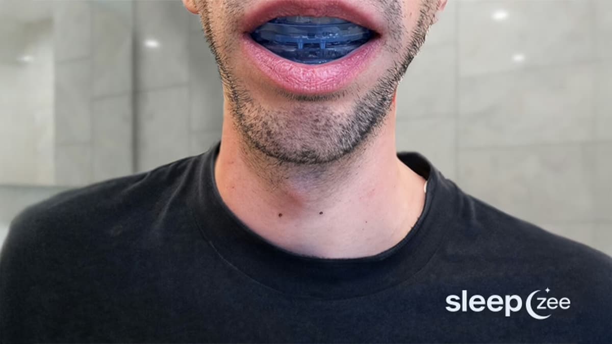 Sleepzee anti-snoring mouthpiece