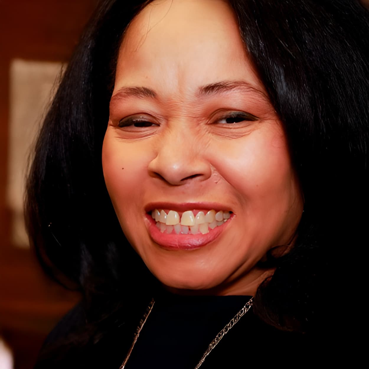 Teeth before Shiny Smile veneers