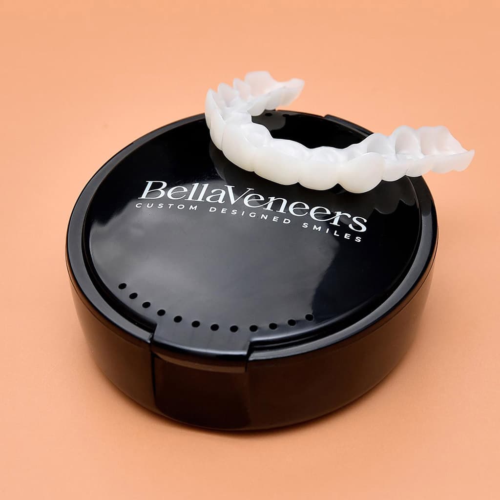 BellaVeneers snap-on veneers